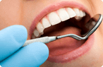 Glendale Dental Check-Ups